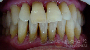 徐世同院长受邀作客腾讯大粤直播间