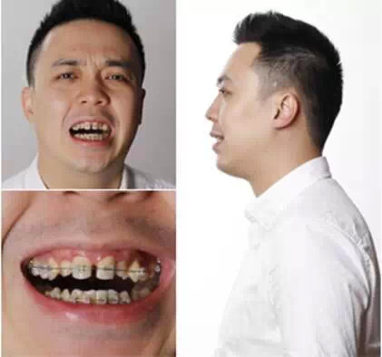 高难度案例